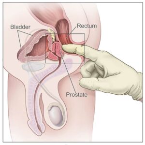 5 things you need to know about your prostate as a man